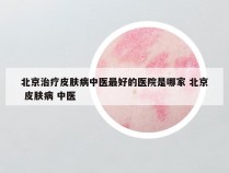 北京治疗皮肤病中医最好的医院是哪家 北京 皮肤病 中医