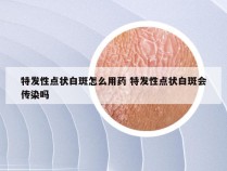 特发性点状白斑怎么用药 特发性点状白斑会传染吗