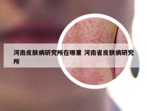 河南皮肤病研究所在哪里 河南省皮肤病研究所