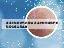 冰溪皮肤修复乳银屑病 冰溪皮肤屏障修护对脂溢性皮炎怎么样