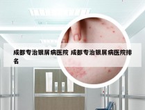 成都专治银屑病医院 成都专治银屑病医院排名