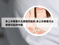 身上长癣是什么原因引起的 身上长癣是什么原因引起的中医