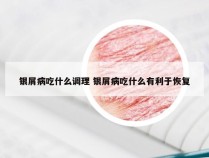 银屑病吃什么调理 银屑病吃什么有利于恢复