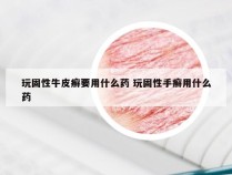 玩固性牛皮癣要用什么药 玩固性手癣用什么药