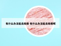 有什么办法能去除癣 有什么办法能去除癣呢