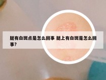 腿有白斑点是怎么回事 腿上有白斑是怎么回事?