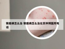 银翘病怎么治 银翘病怎么治北京仲博医院电话