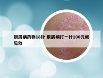 银屑病药物18针 银屑病打一针100元就见效