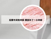 后腰中间有块癣 腰部长了一小块癣