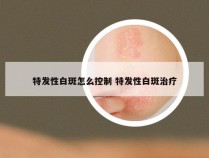 特发性白斑怎么控制 特发性白斑治疗