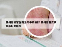 贵州省哪家医院治疗牛皮癣好 贵州省看皮肤病最好的医院