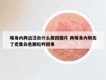 嘴角内两边泛白什么原因图片 两嘴角内侧出了密集白色颗粒咋回事