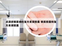 点滴状银屑病吃复方青黛胶囊 银屑胶囊和复方青黛胶囊