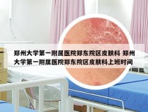 郑州大学第一附属医院郑东院区皮肤科 郑州大学第一附属医院郑东院区皮肤科上班时间