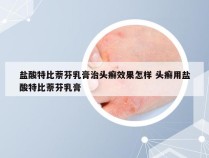 盐酸特比萘芬乳膏治头癣效果怎样 头癣用盐酸特比萘芬乳膏