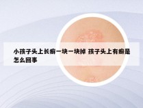 小孩子头上长癣一块一块掉 孩子头上有癣是怎么回事