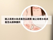 腿上出现小白点是怎么回事 腿上出现小白点是怎么回事图片