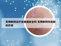 生物制剂治疗皮肤病安全吗 生物制剂对皮肤的作用