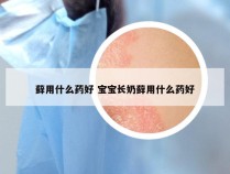 藓用什么药好 宝宝长奶藓用什么药好