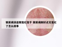 银屑病消退期变红变干 银屑病刚好点又变红了怎么回事