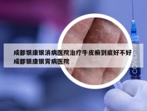 成都银康银消病医院治疗牛皮癣到底好不好 成都银康银霄病医院