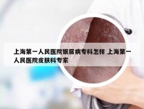 上海第一人民医院银屑病专科怎样 上海第一人民医院皮肤科专家