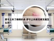 脖子上长了癣痒的狠 脖子上长癣又痒又痛怎么办?