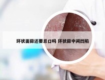 环状面藓还要忌口吗 环状藓中间凹陷