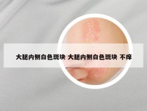 大腿内侧白色斑块 大腿内侧白色斑块 不痒