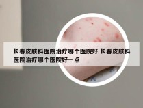 长春皮肤科医院治疗哪个医院好 长春皮肤科医院治疗哪个医院好一点