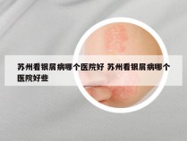 苏州看银屑病哪个医院好 苏州看银屑病哪个医院好些