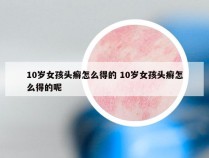 10岁女孩头癣怎么得的 10岁女孩头癣怎么得的呢