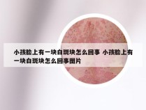 小孩脸上有一块白斑块怎么回事 小孩脸上有一块白斑块怎么回事图片