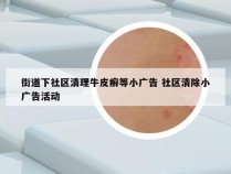 街道下社区清理牛皮癣等小广告 社区清除小广告活动