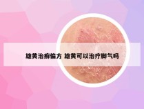 雄黄治癣偏方 雄黄可以治疗脚气吗