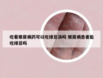 吃着银屑病药可以吃绿豆汤吗 银屑病患者能吃绿豆吗