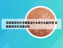 百癣夏塔热片主要是治什么有什么副作用 百癣夏塔热片百度百科