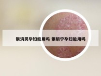 银消灵孕妇能用吗 银硝宁孕妇能用吗