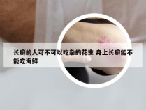 长癣的人可不可以吃杂的花生 身上长癣能不能吃海鲜