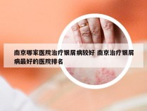 南京哪家医院治疗银屑病较好 南京治疗银屑病最好的医院排名