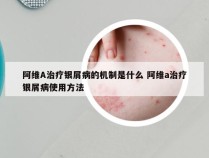 阿维A治疗银屑病的机制是什么 阿维a治疗银屑病使用方法