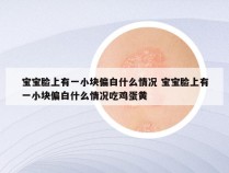 宝宝脸上有一小块偏白什么情况 宝宝脸上有一小块偏白什么情况吃鸡蛋黄