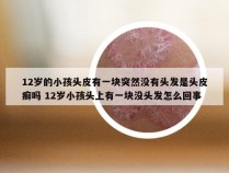 12岁的小孩头皮有一块突然没有头发是头皮癣吗 12岁小孩头上有一块没头发怎么回事