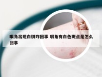 眼角出现白斑咋回事 眼角有白色斑点是怎么回事