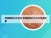 生物制剂几针见效 生物制剂打几针才见到效果