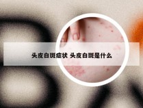 头皮白斑症状 头皮白斑是什么