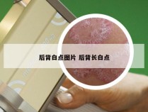 后背白点图片 后背长白点