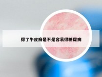 得了牛皮癣是不是容易得糖尿病