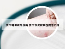 普宁哪里看牛皮癣 普宁市皮肤病医院怎么样