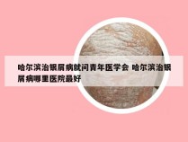 哈尔滨治银屑病就问青年医学会 哈尔滨治银屑病哪里医院最好